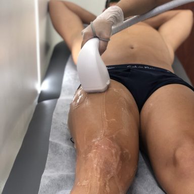 depilación laser en granada para hombre